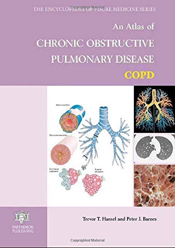 An Atlas of Chronic Obstructive Pulmonary Disease: Copd (Encyclopedia of Visual Medicine Series, Band 73) Medicine