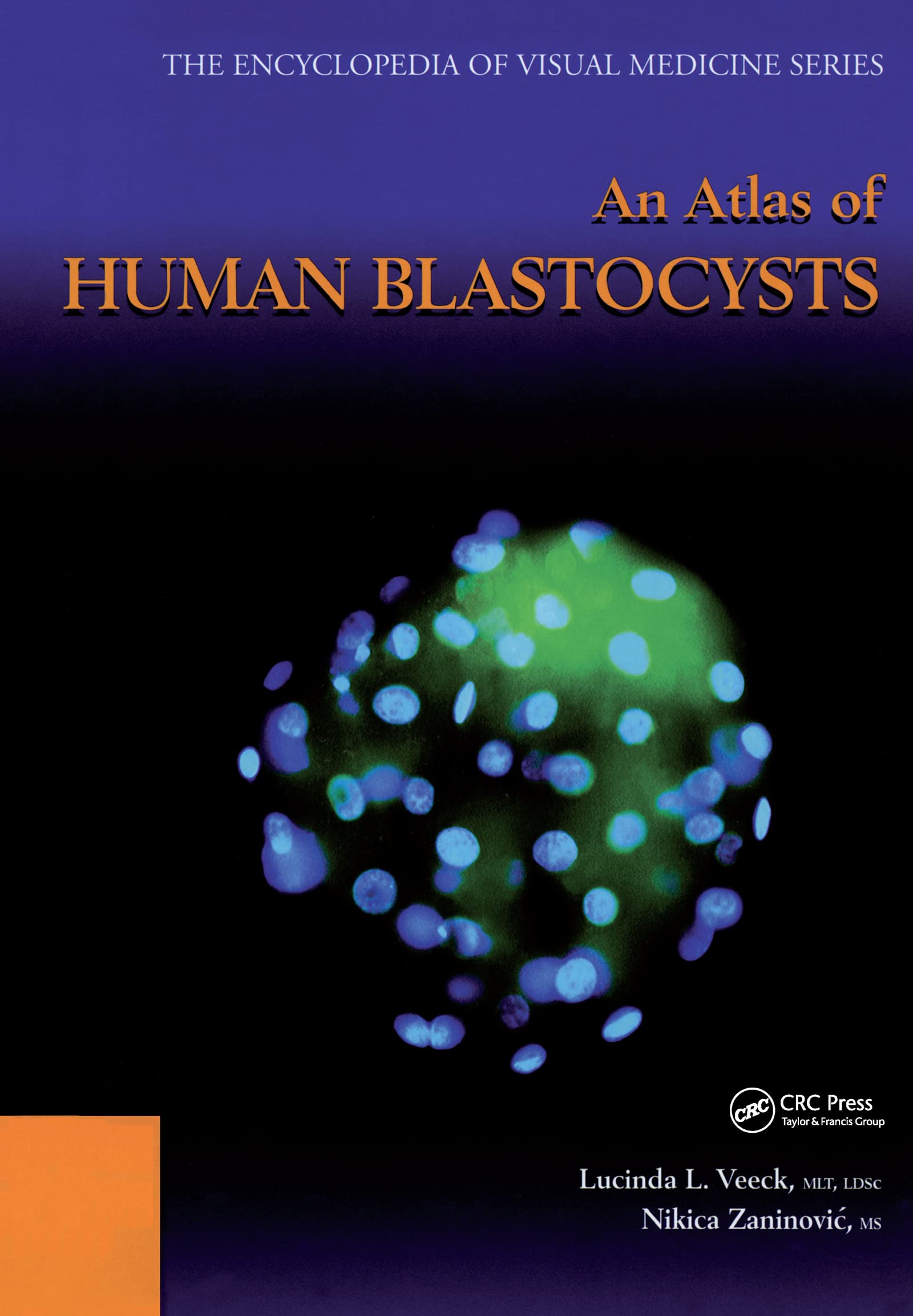 An Atlas of Human Blastocysts (Encyclopedia of Visual Medicine Series, 59, Band 59) Medicine