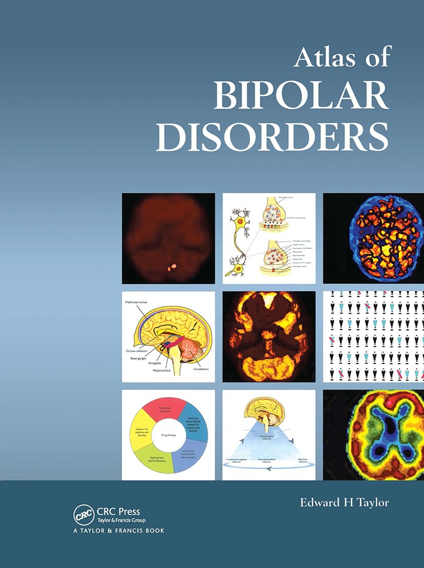 Atlas of Bipolar Disorders (Encyclopedia of Visual Medicine Series) Medicine