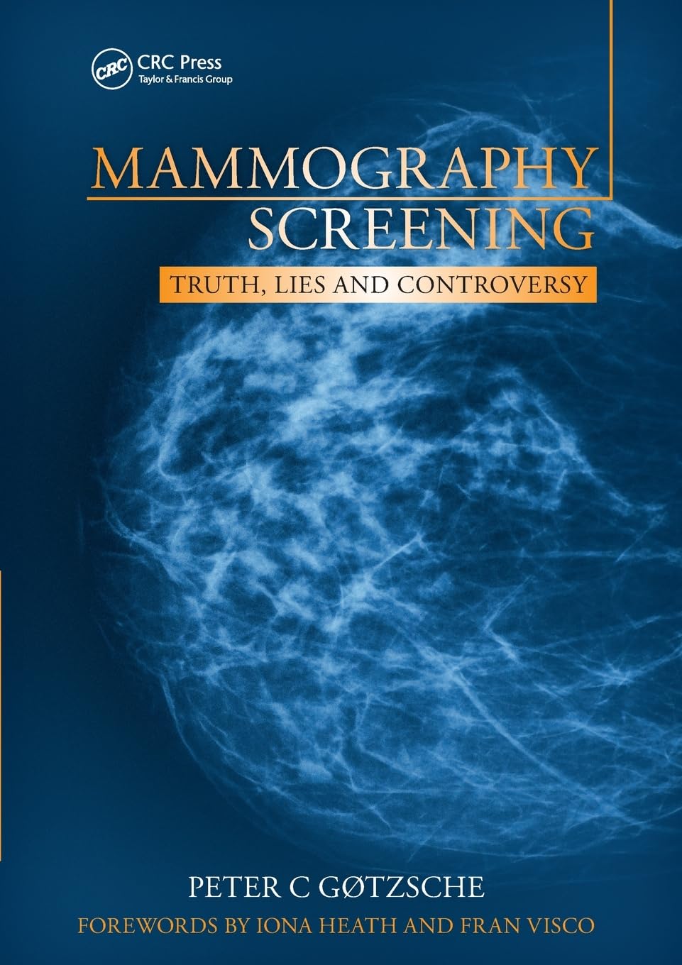 Mammography Screening: Truth, Lies and Controversy Medicine