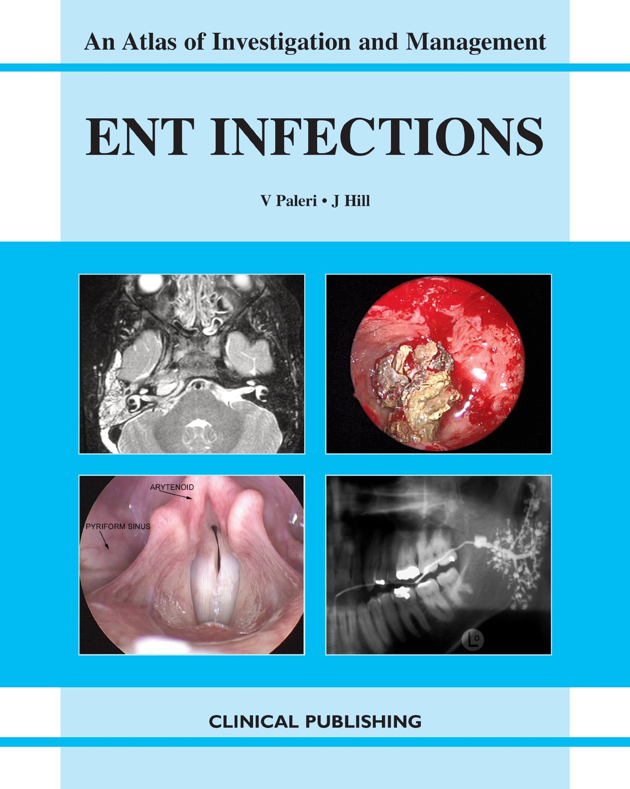 ENT Infections (Atlas of Investigation and Management) Medicine