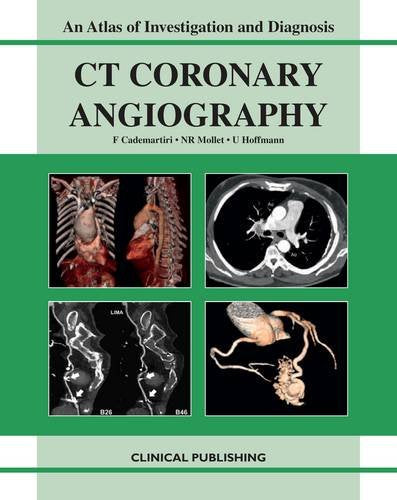 CT Coronary Angiography: Atlas of Investigation and Management Medicine