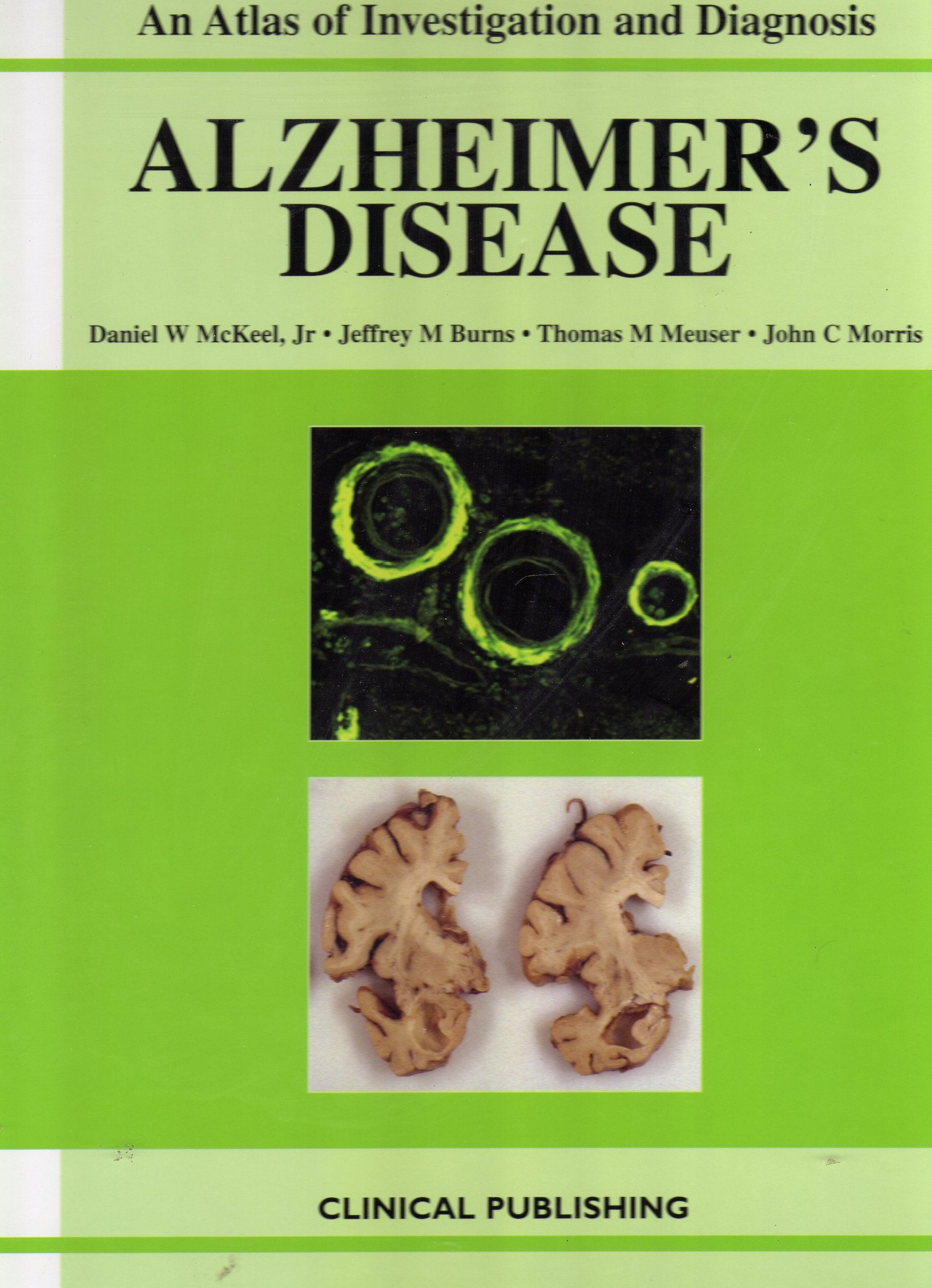 Alzheimer's Disease | An Atlas of Investigation an Books