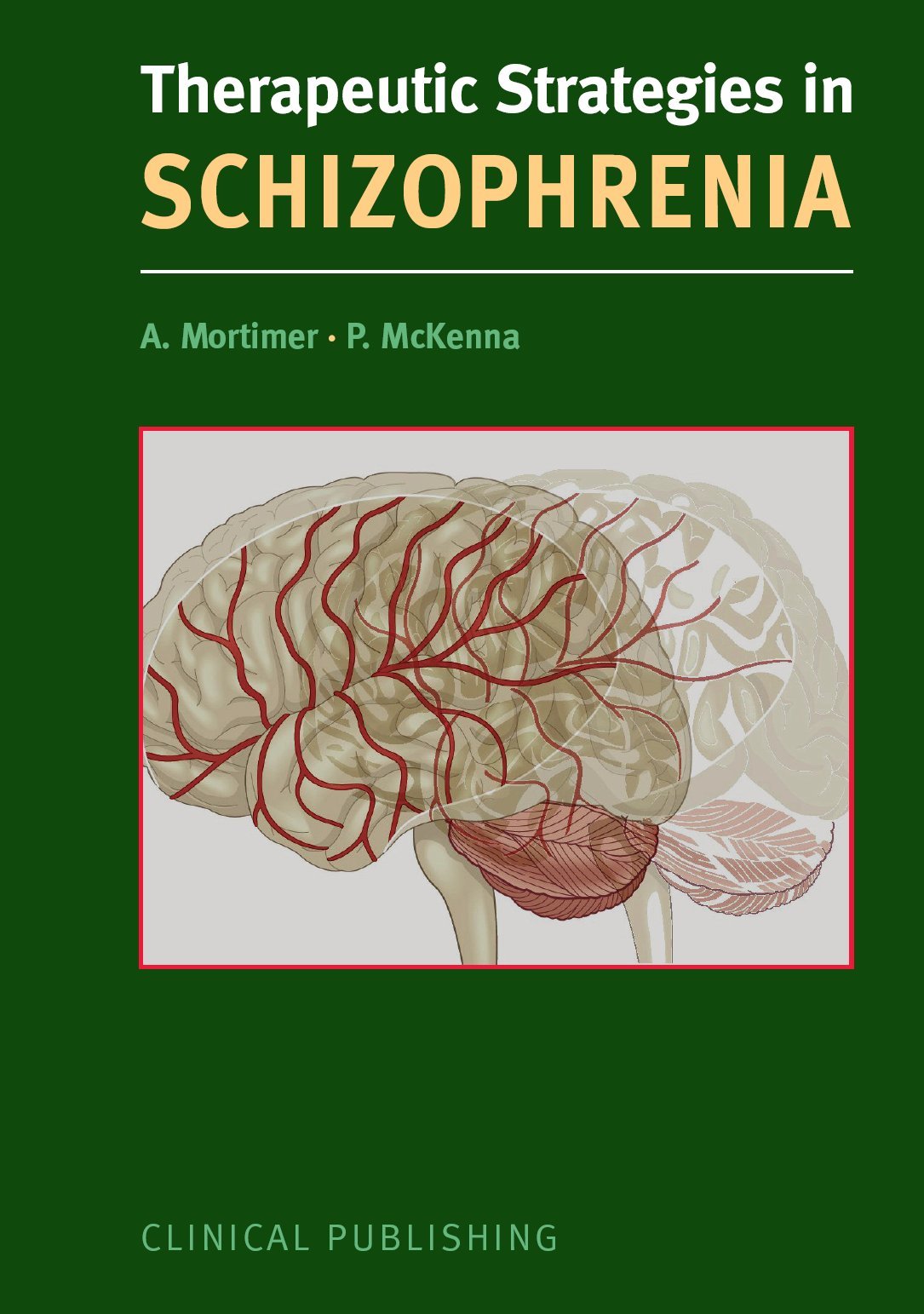 Schizophrenia (Therapeutic Strategies in ...) Medicine