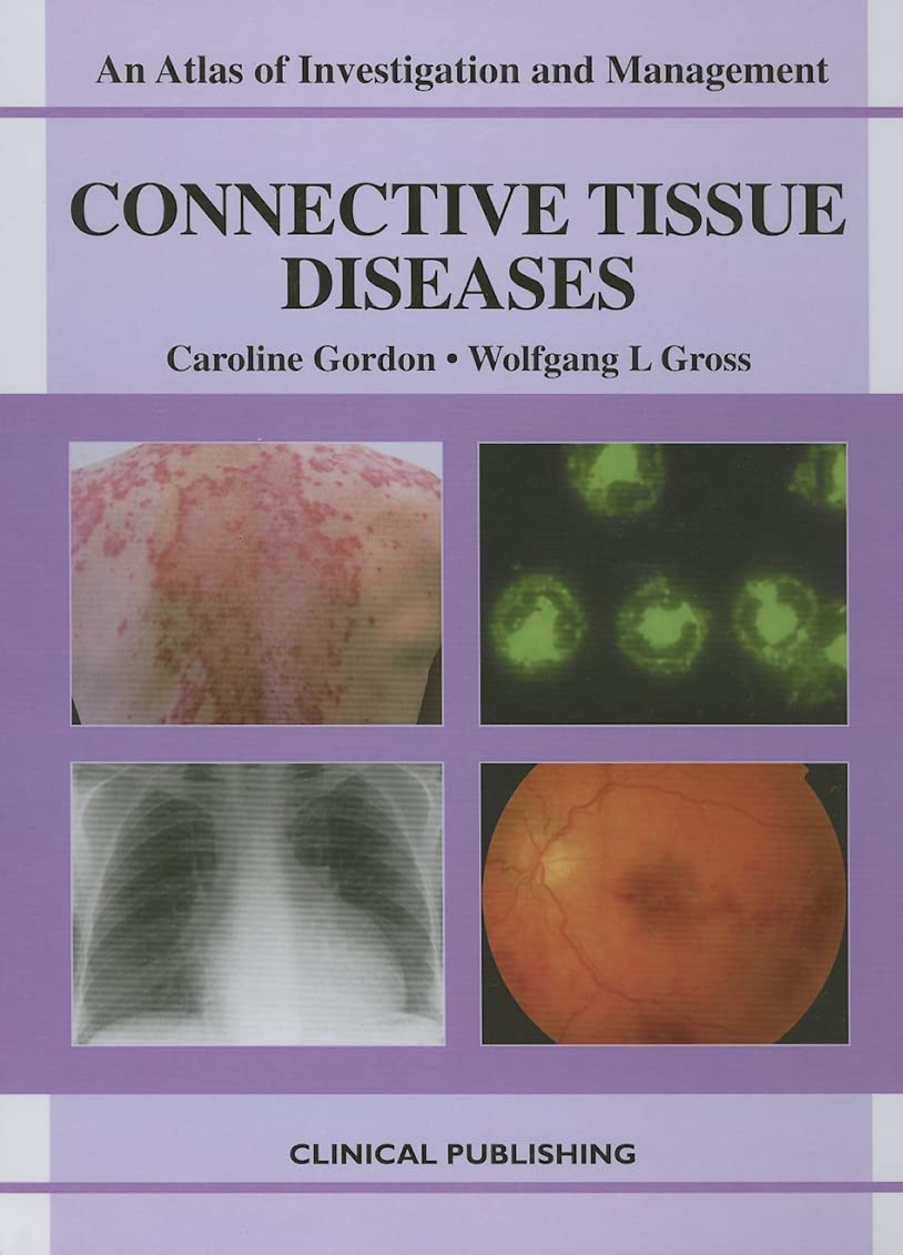 Connective Tissue Diseases (Atlas of Investigation and Management) Medicine