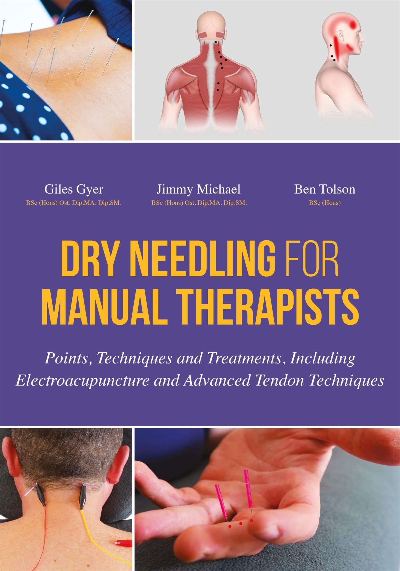 Dry Needling for Manual Therapists Medicine