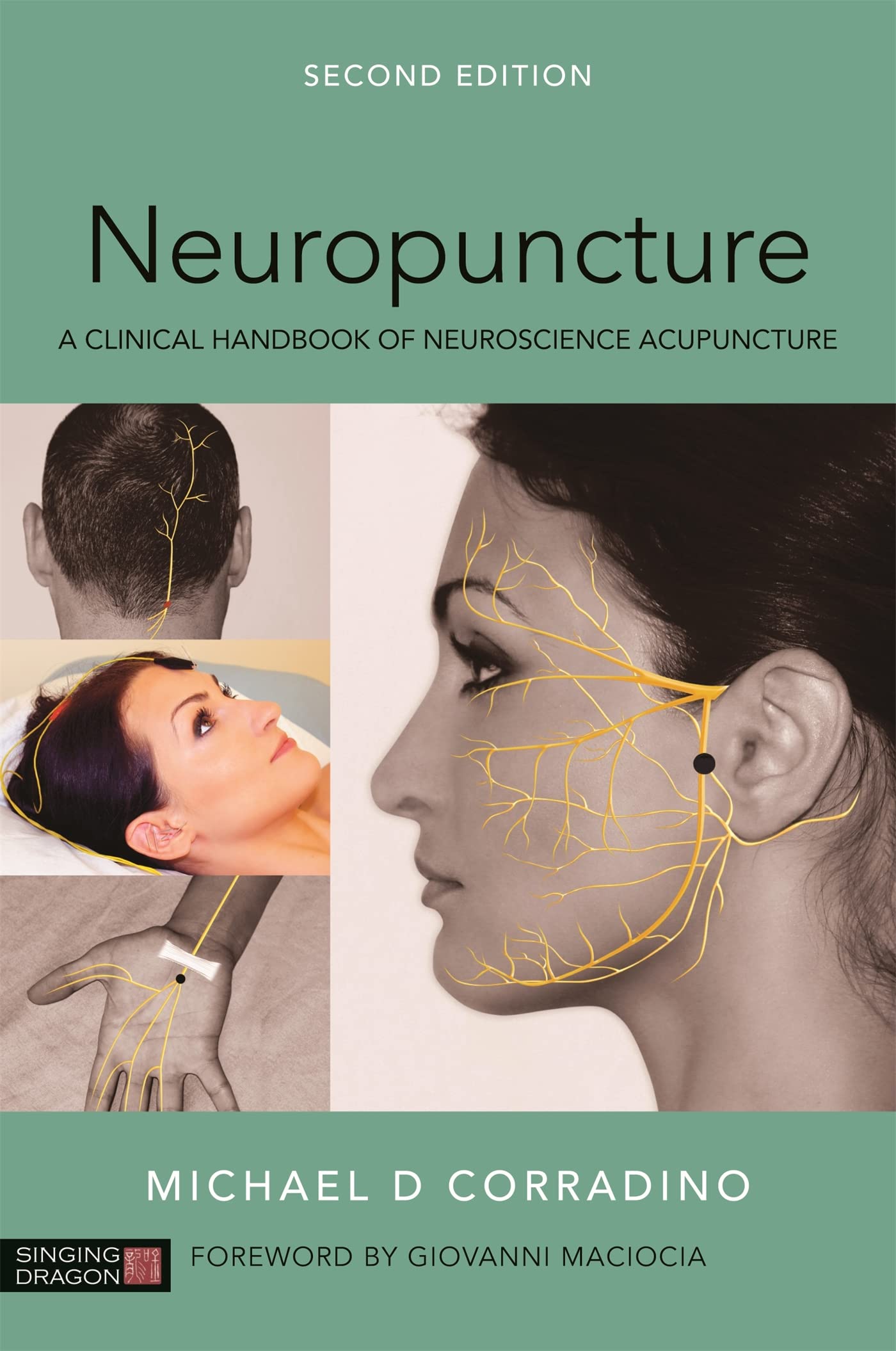 Neuropuncture: A Clinical Handbook of Neuroscience Acupuncture Medicine