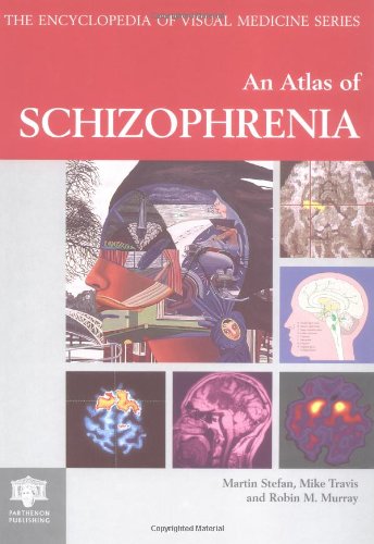 Atlas of Schizophrenia (Encyclopedia of Visual Medicine Series) Medicine