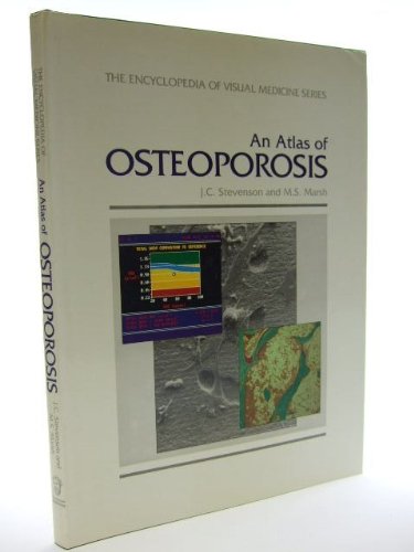 An Atlas of Osteoporosis book