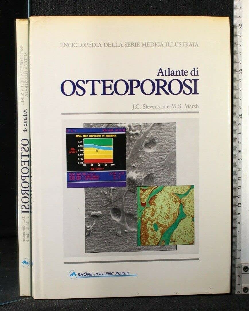 An Atlas of Hypertension (The Encyclopedia of Visual Medicine Series) Medicine