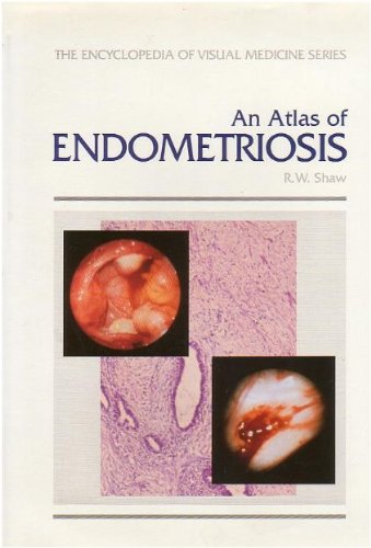 An Atlas of Endometriosis (The Encyclopedia of Visual Medicine Series) Medicine