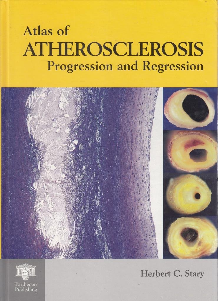 An Atlas of Atherosclerosis and Endothelial Damage: Progression and Regression (Encyclopedia of Visual Medicine) Medicine