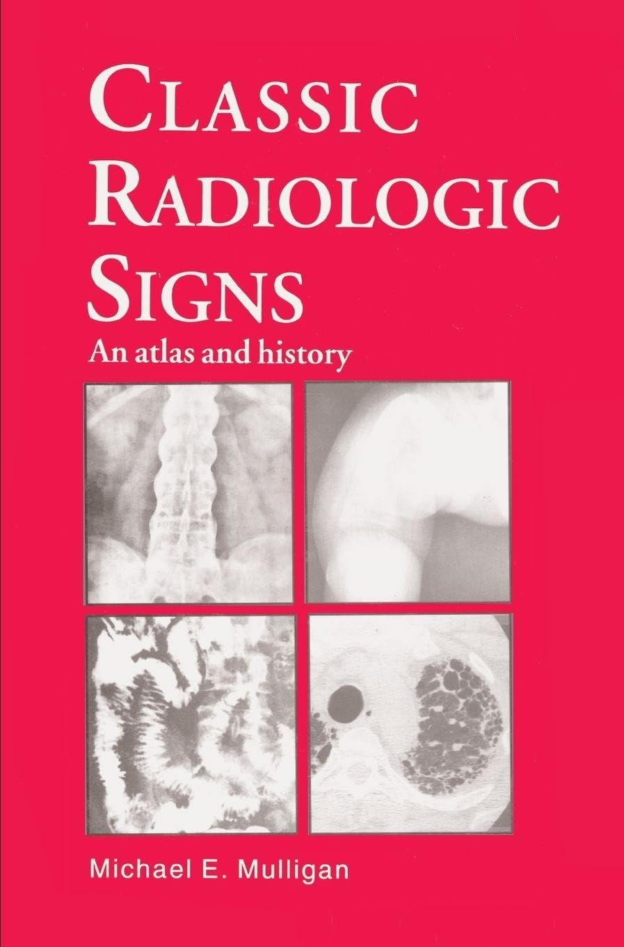 Product Image: Classic Radiologic Signs