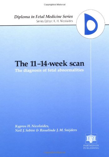 The 11-14-Week Scan: The Diagnosis of Fetal Abnormalities (Diploma in Fetal Medicine Series) Medicine