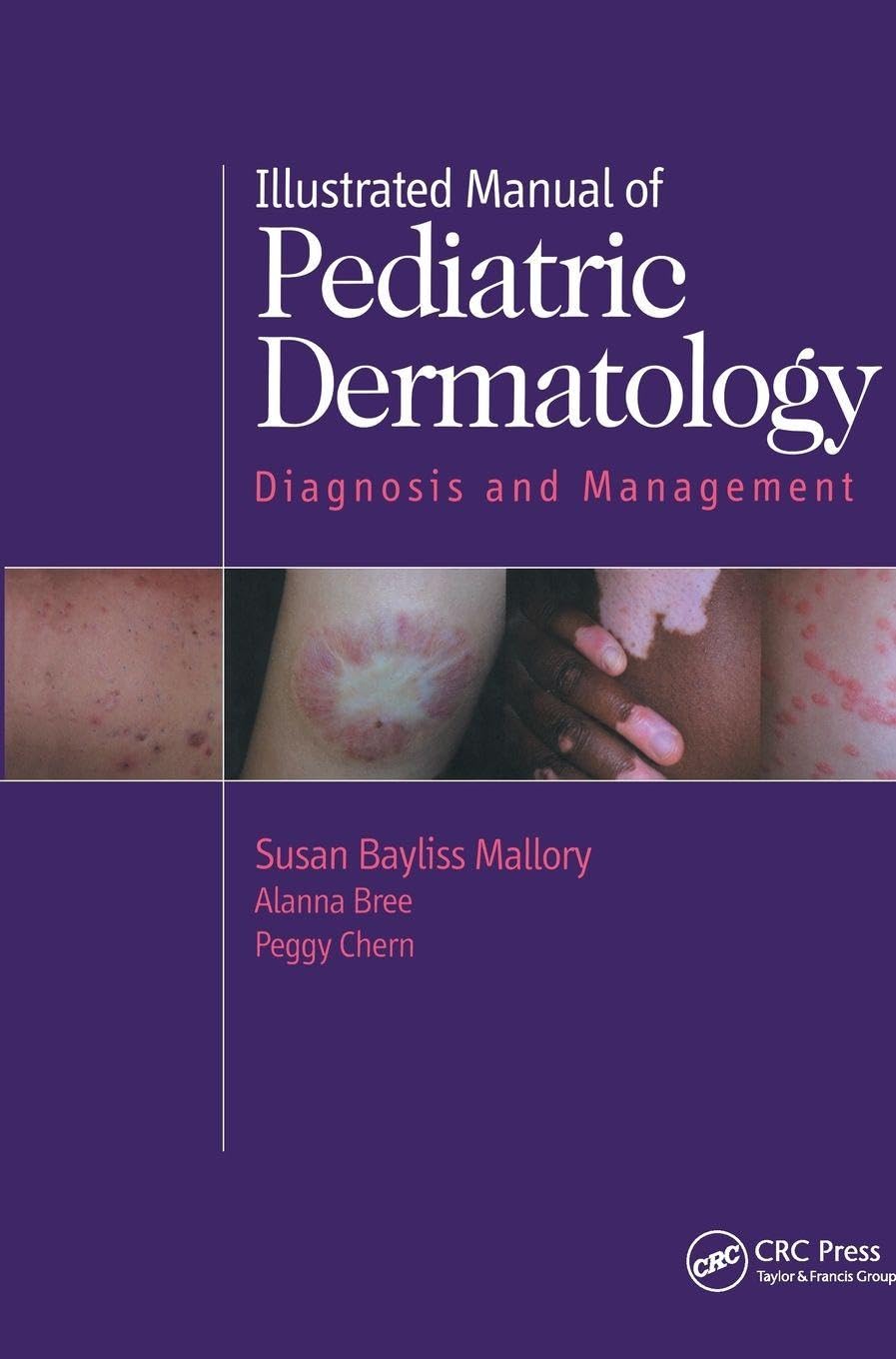 Illustrated Manual of Pediatric Dermatology Medicine