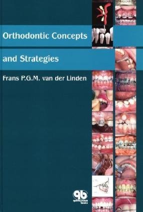 Orthodontic Concepts and Strategies Medicine