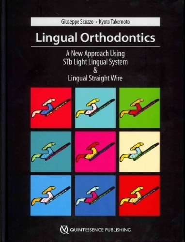 Lingual Orthodontics: A New Approach Using Stb Light Lingual System & Lingual Straight Wire Medicine