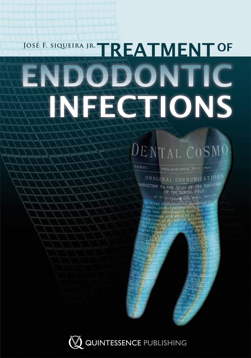 Treatment of Endodontic Infections Medicine