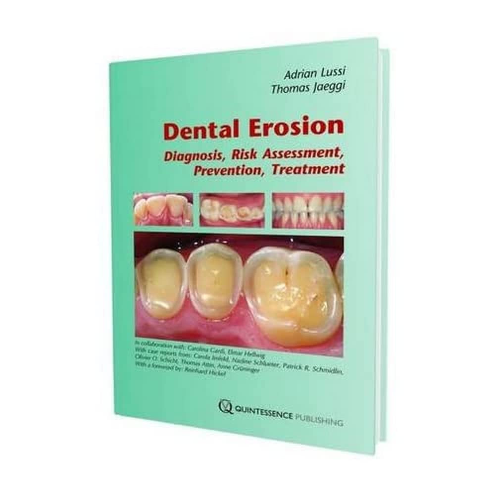 Dental Erosion: Diagnosis, Risk Assessment, Prevention, Treatment book