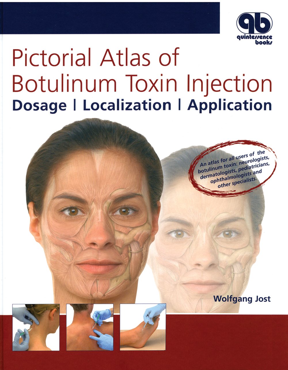 Pictorial Atlas of Botulinum Toxin Injection: Dosage, Localization, Application Medicine