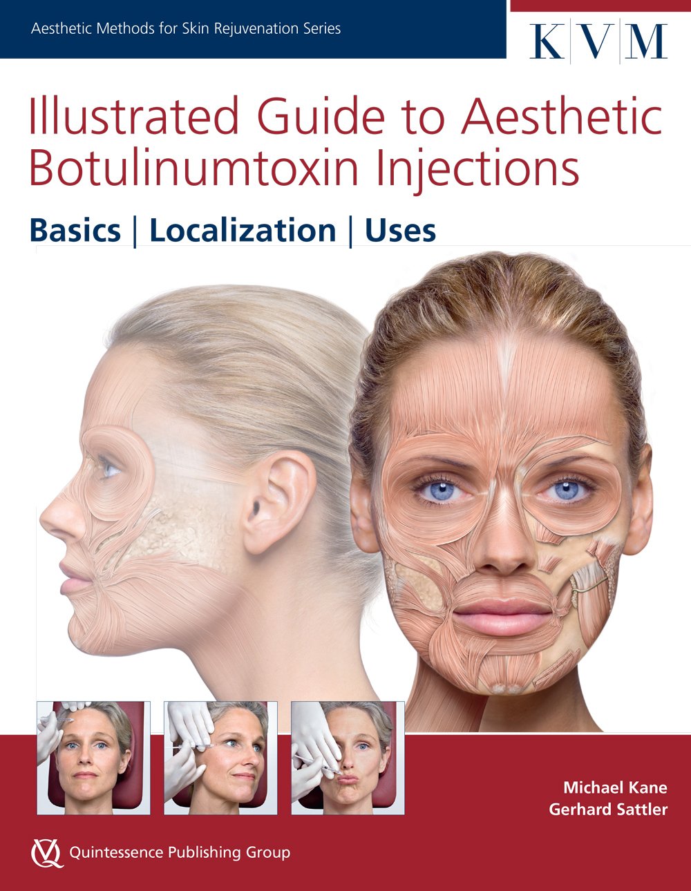 Illustrated Guide to Aesthetic Botulinum Toxin Injections: Basics / Localization / Uses book