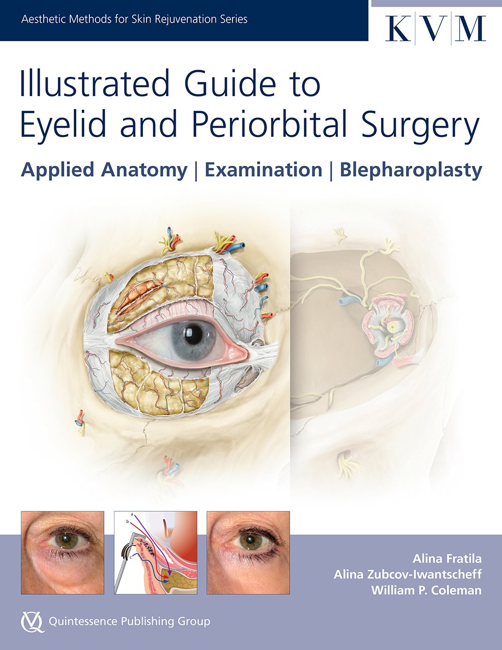 Illustrated Guide to Eyelid and Periorbital Surgery: Applied Anatomy | Examination | Blepharoplasty (Aesthetic Methods for Skin Rejuvenation Series) Medicine