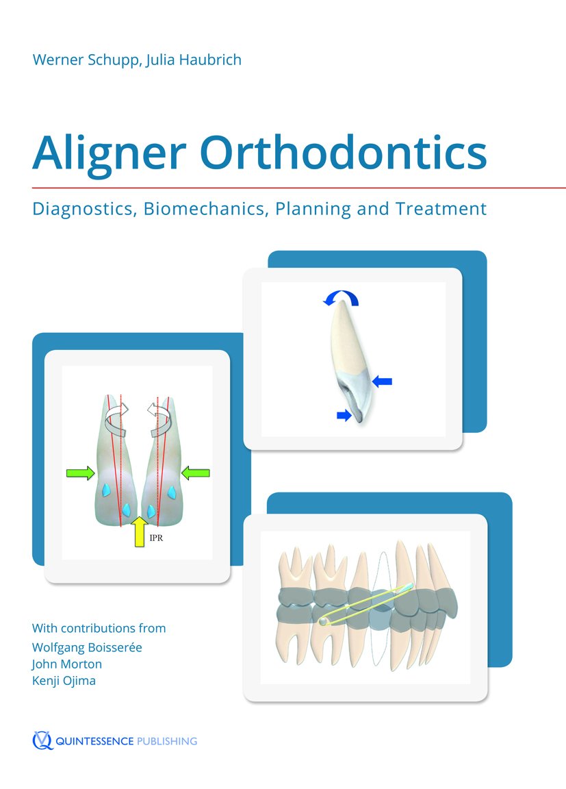 Aligner Orthodontics: Diagnostics, Biomechanics, Planning and Treatment Medicine