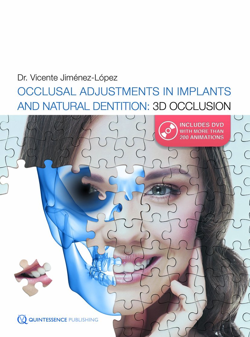Occlusal Adjustments in Implants and Natural Dentition: 3D Occlusion: TMJ pathology related to occlusion: etiopathology and treatment Medicine