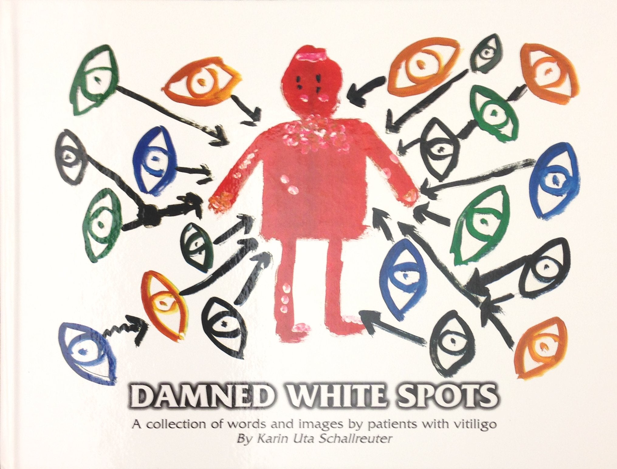 Damned White Spots: A Collection of Words and Images by Patients with Vitiligo Contemporary literature