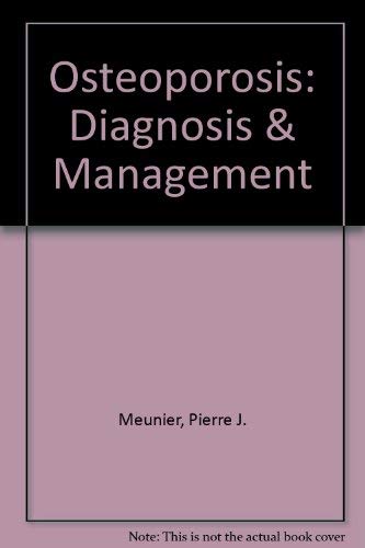 Osteoporosis: Diagnosis & Management Medicine