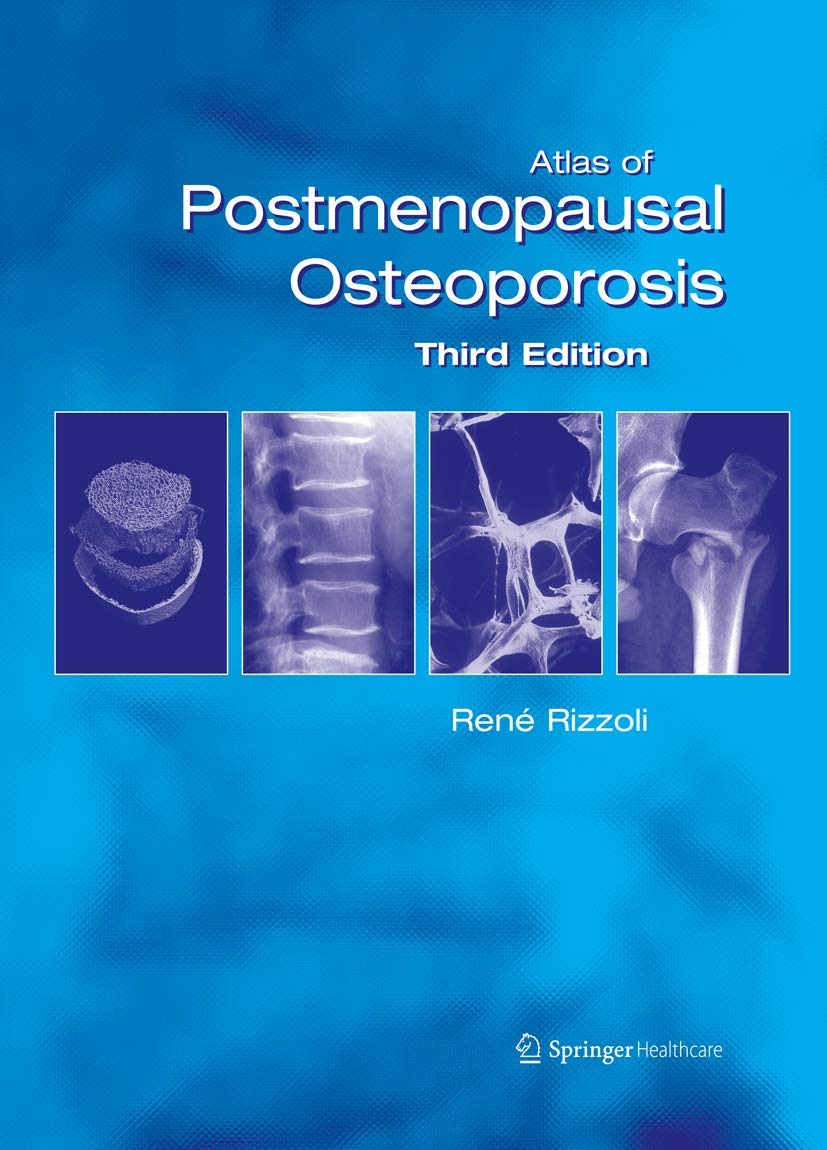 Atlas of Postmenopausal Osteoporosis: Third Edition Medicine