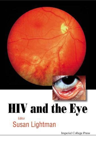 Product Image: HIV & THE EYE