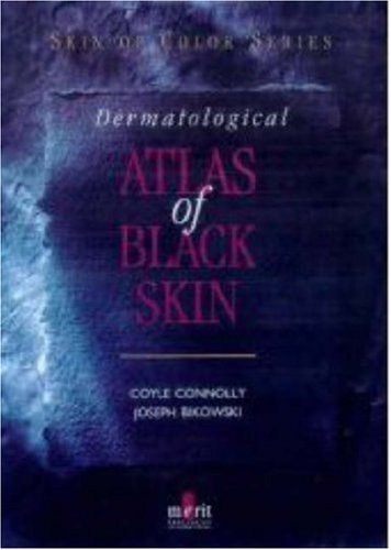 Dermatological Atlas of Black Skin book