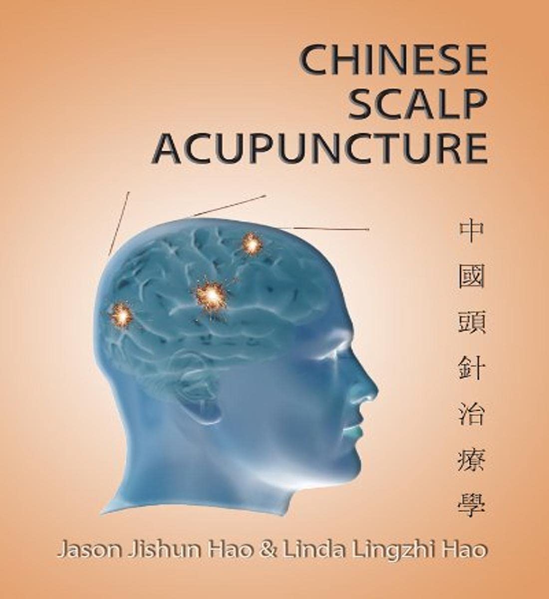 Chinese Scalp Acupuncture Books