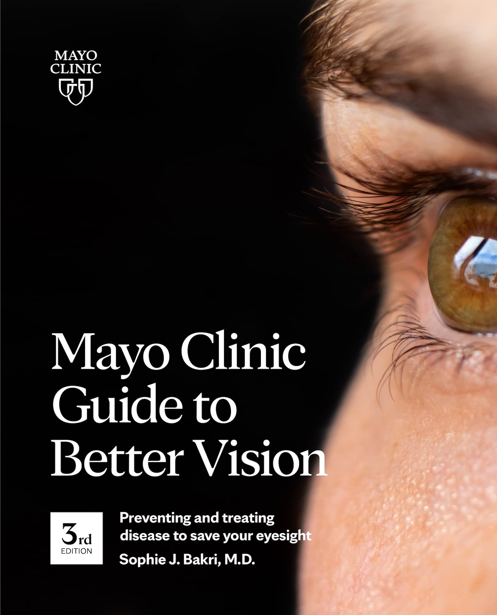 Mayo Clinic Guide to Better Vision, 3rd Ed Medicine