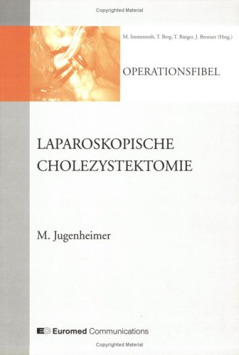 Laparoskopische Cholezystektomie: v. 2 Medicine