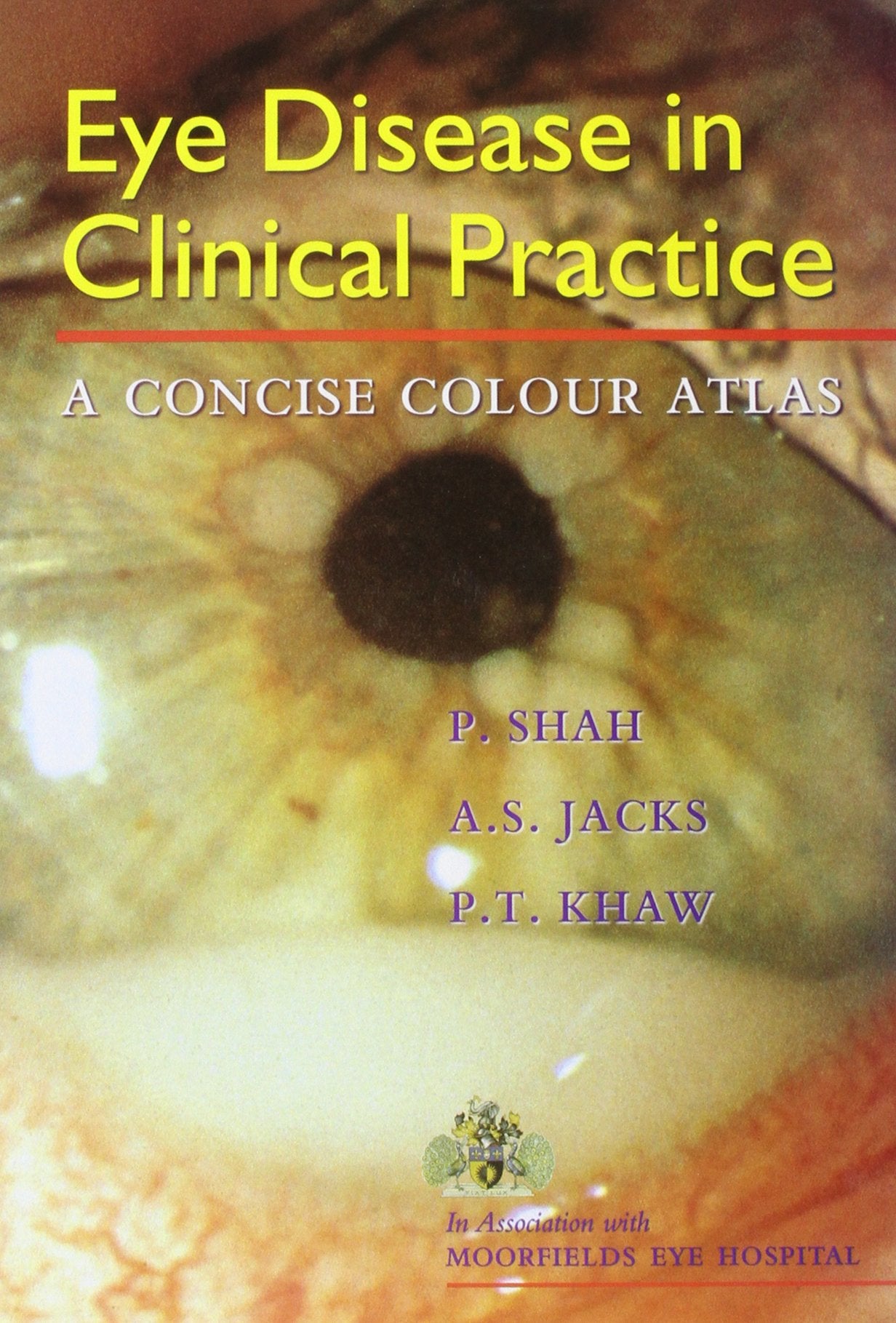 Eye Disease in Clinical Practice: A Concise Colour Atlas book