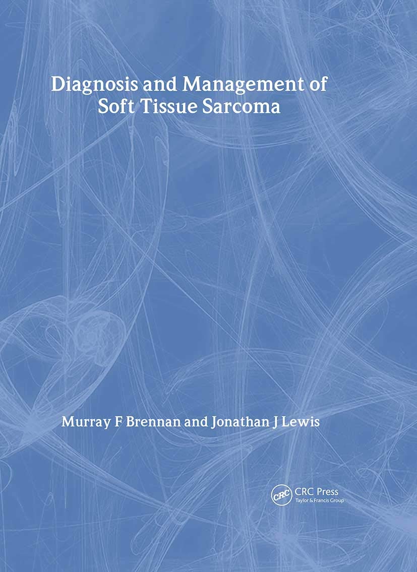 Diagnosis and Management of Soft Tissue Sarcoma Medicine