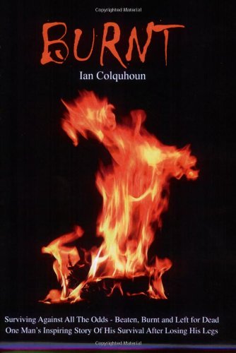 Burnt: Surviving Against All the Odds - Beaten, Burnt and Left for Dead. One Man's Inspiring Story of His Survival After Losing His Legs Memories
