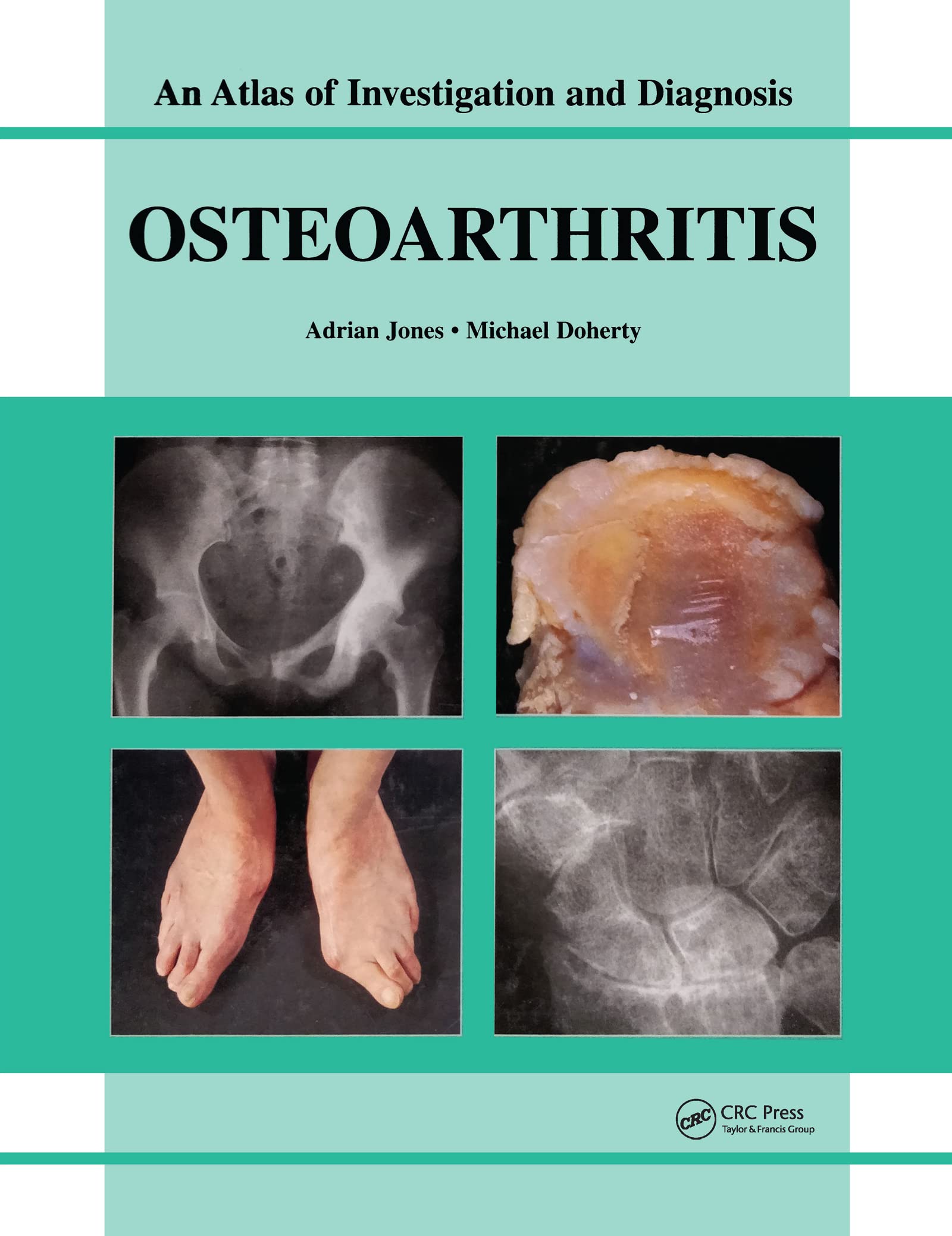 Oesteoarthritis: An Atlas of Investigation and Diagnosis book