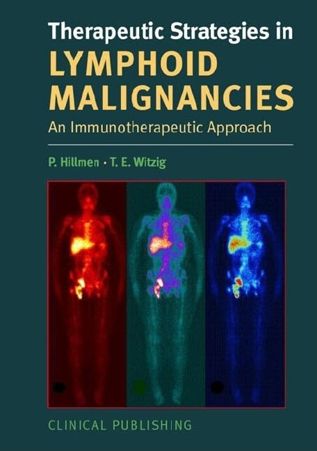 Therapeutic Strategies in Lymphoid Malignancy: An Immunotherapeutic Approach Medicine