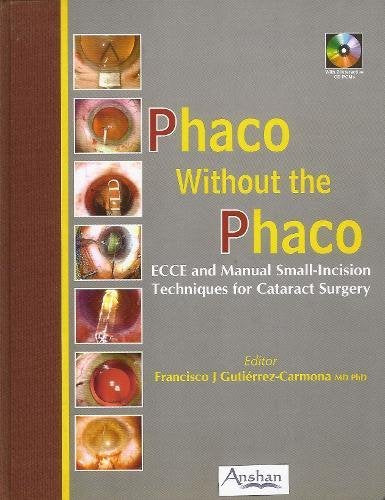 Phaco Without the Phaco: ECCE And Manual Small-Incision Techniques for Cataract Surgery Medicine