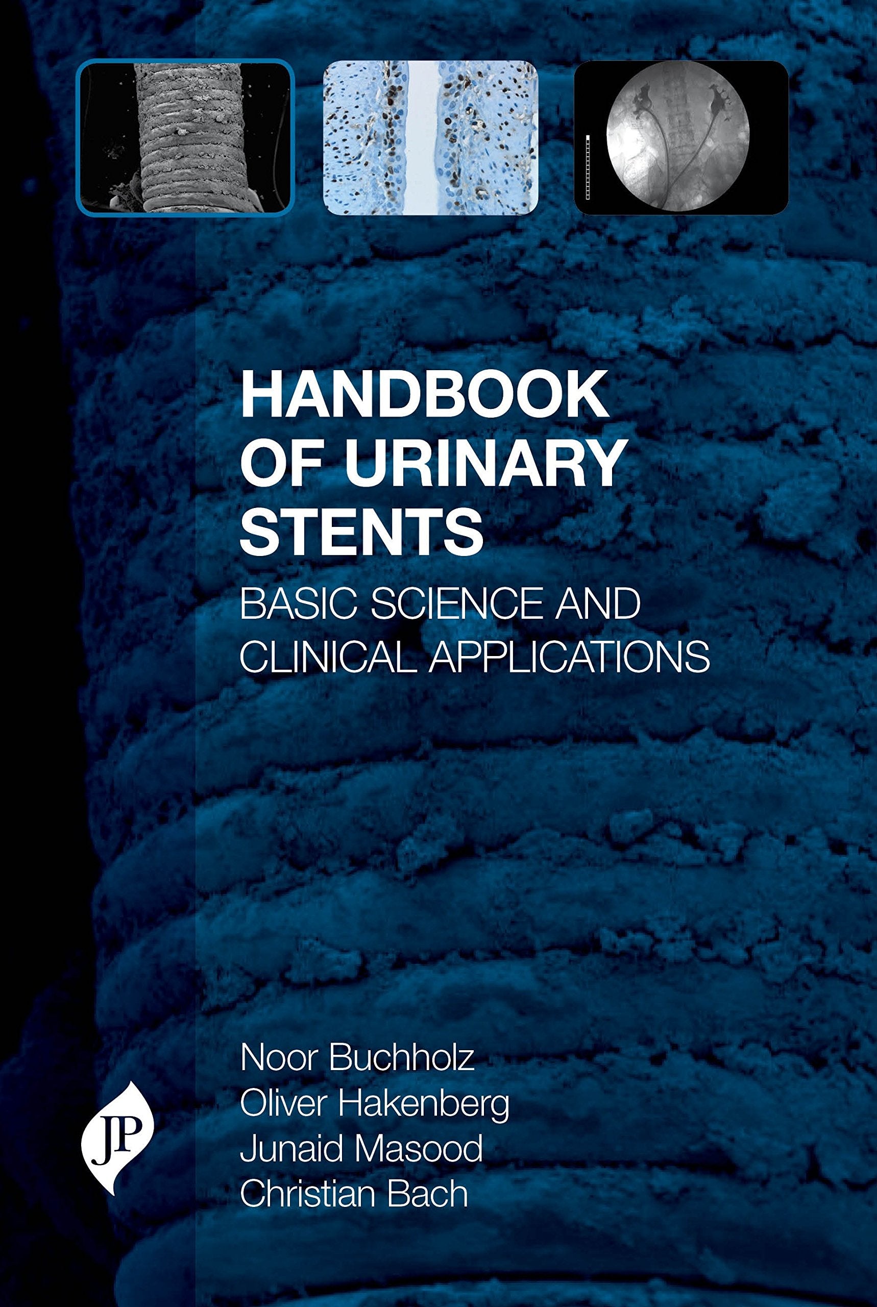 Buchholz, N: Handbook of Urinary Stents Medicine