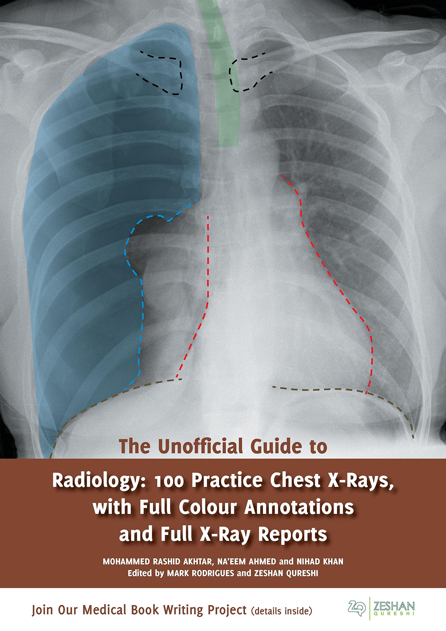 The Unofficial Guide to Radiology: 100 Practice Chest X Rays with Full Colour Annotations and Full X Ray Reports (Unofficial Guides) Medicine