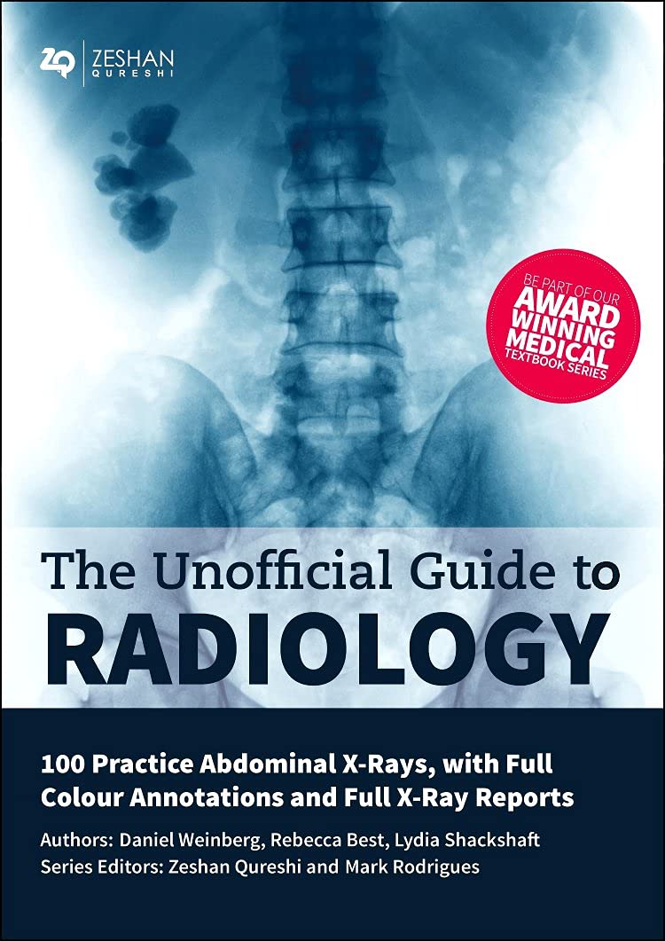 Unofficial Guide to Radiology: 100 Practice Abdominal X Rays with Full Colour Annotations and Full X Ray Reports (Unofficial Guides) Medicine