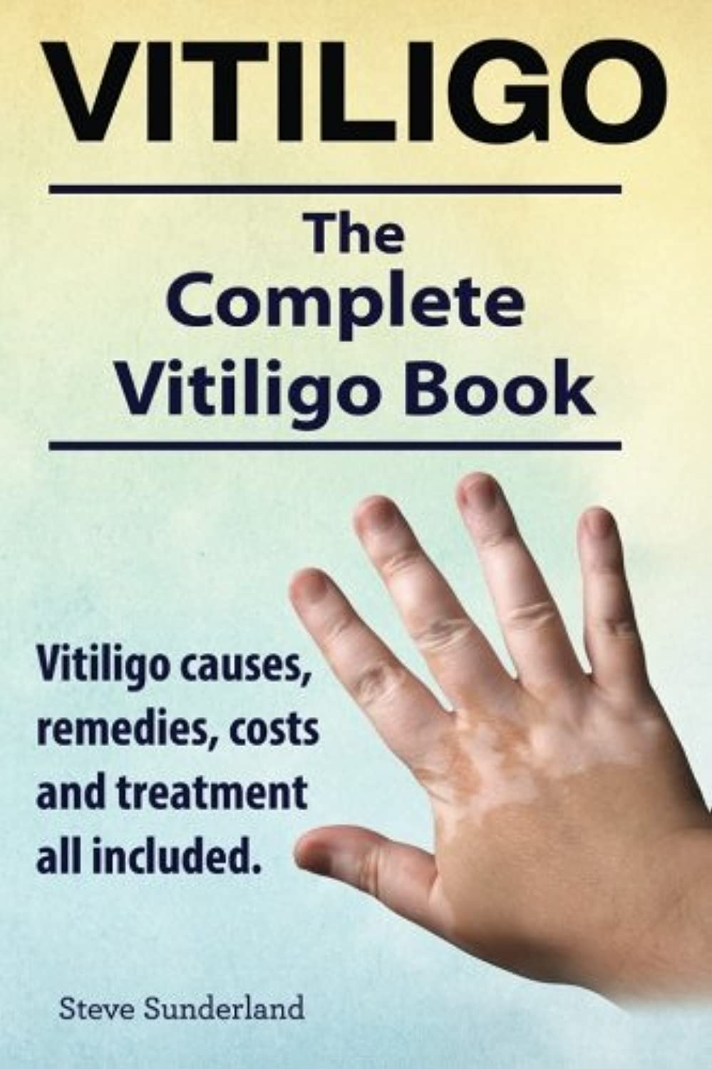 Vitiligo. Vitiligo causes, remedies, costs and treatment all included. The complete Vitiligo Book. book