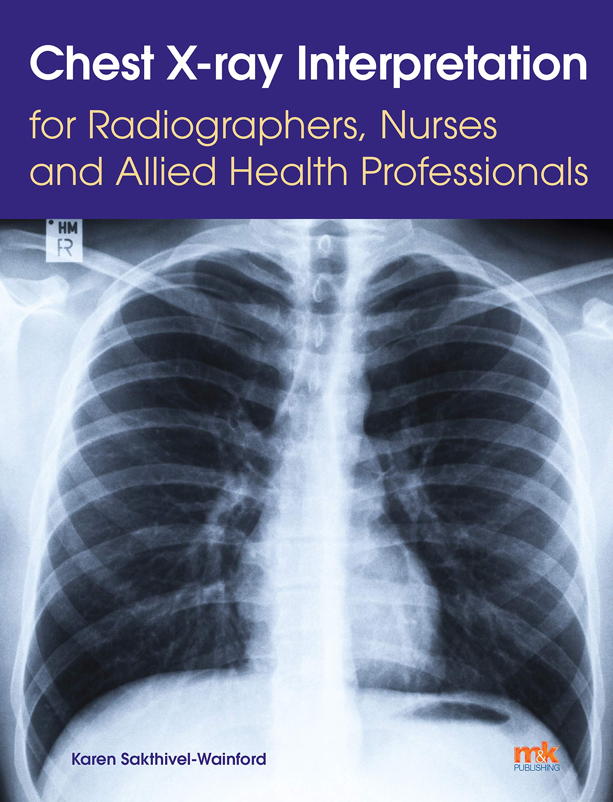 Chest X-ray Interpretation for Radiographers, Nurses and Allied Health Professionals Medicine