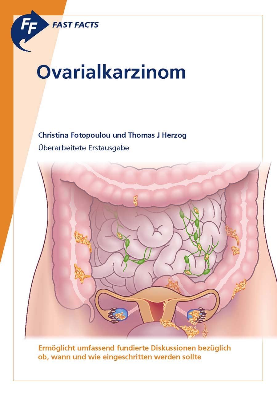 Product Image: Fast Facts: Ovarialkarzinom