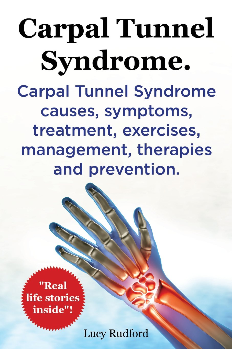 Carpal Tunnel Syndrome. Carpal Tunnel Syndrome causes, symptoms, treatment, exercises, management, therapies and prevention. Real Life Stories Inside!. Contemporary literature Books