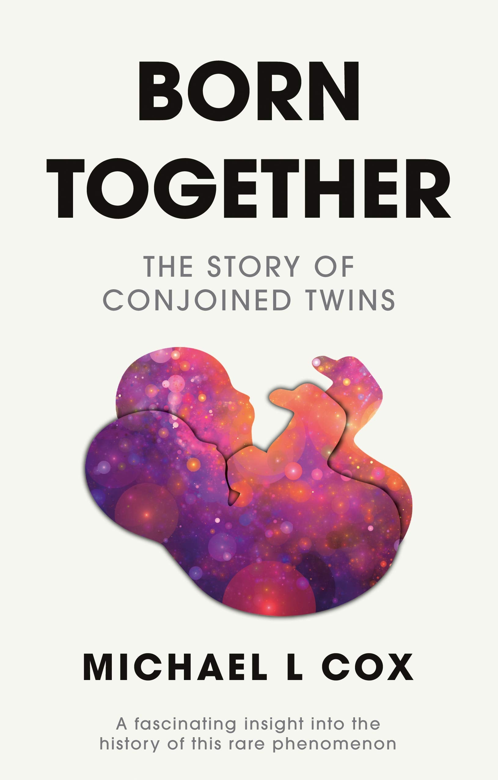 Born Together: The Story of Conjoined Twins Business & Technology